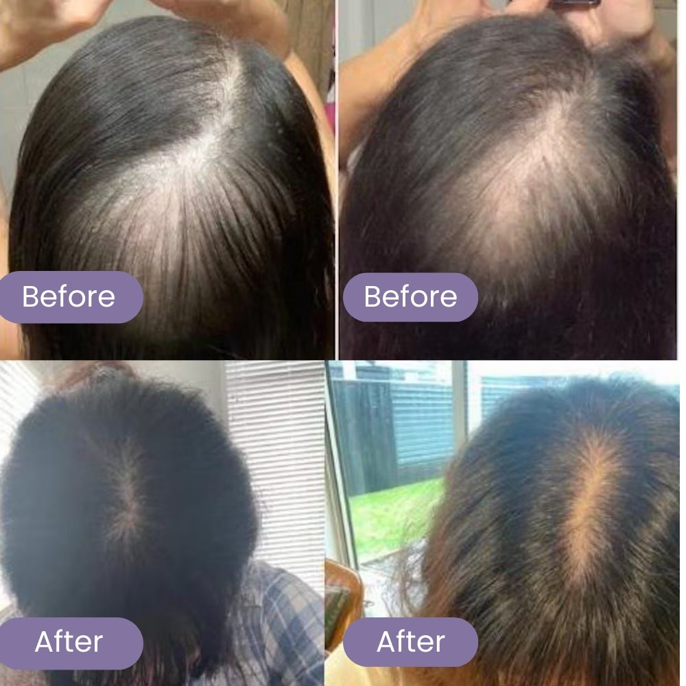 SIERO NATURALE PER LA CRESCITA DEI CAPELLI