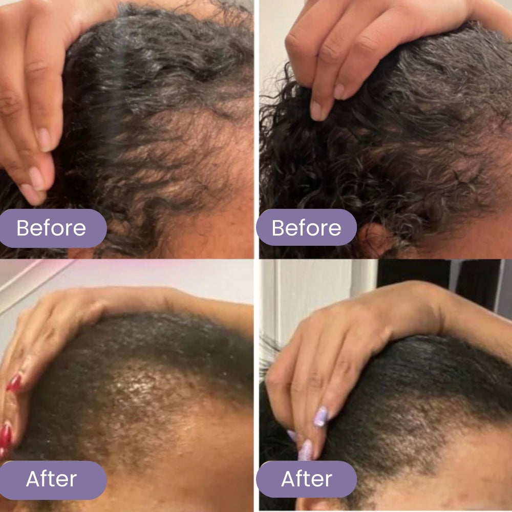 SIERO NATURALE PER LA CRESCITA DEI CAPELLI